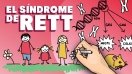 "Síndrome de Rett: comprendiendo el trastorno genético del desarrollo neurológico que afecta más a niñas"